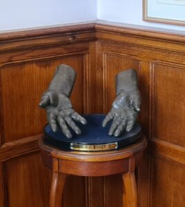 Harry Edwards Hands Cu